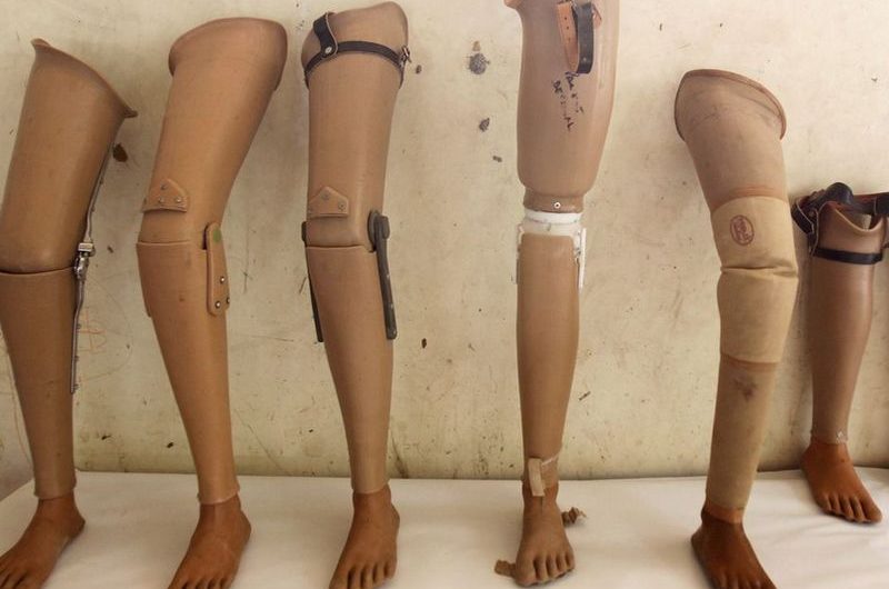 Togo : Affaire de prothèses périmées au CHU, l’appel de la LCT