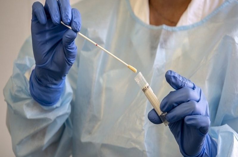 Togo/coronavirus: cinq(05) centres de santé dédiés pour des tests gratuits au covid-19 à Lomé.
