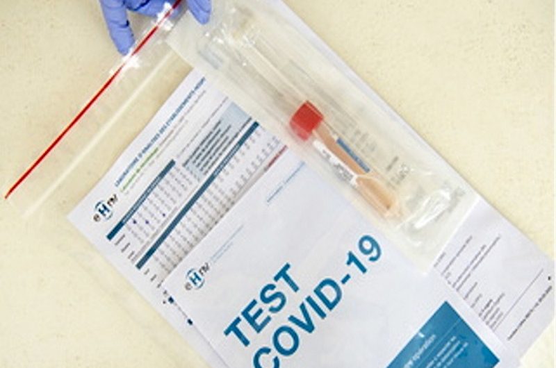 Togo/Covid-19: le coût du test PCR revu à la baisse.
